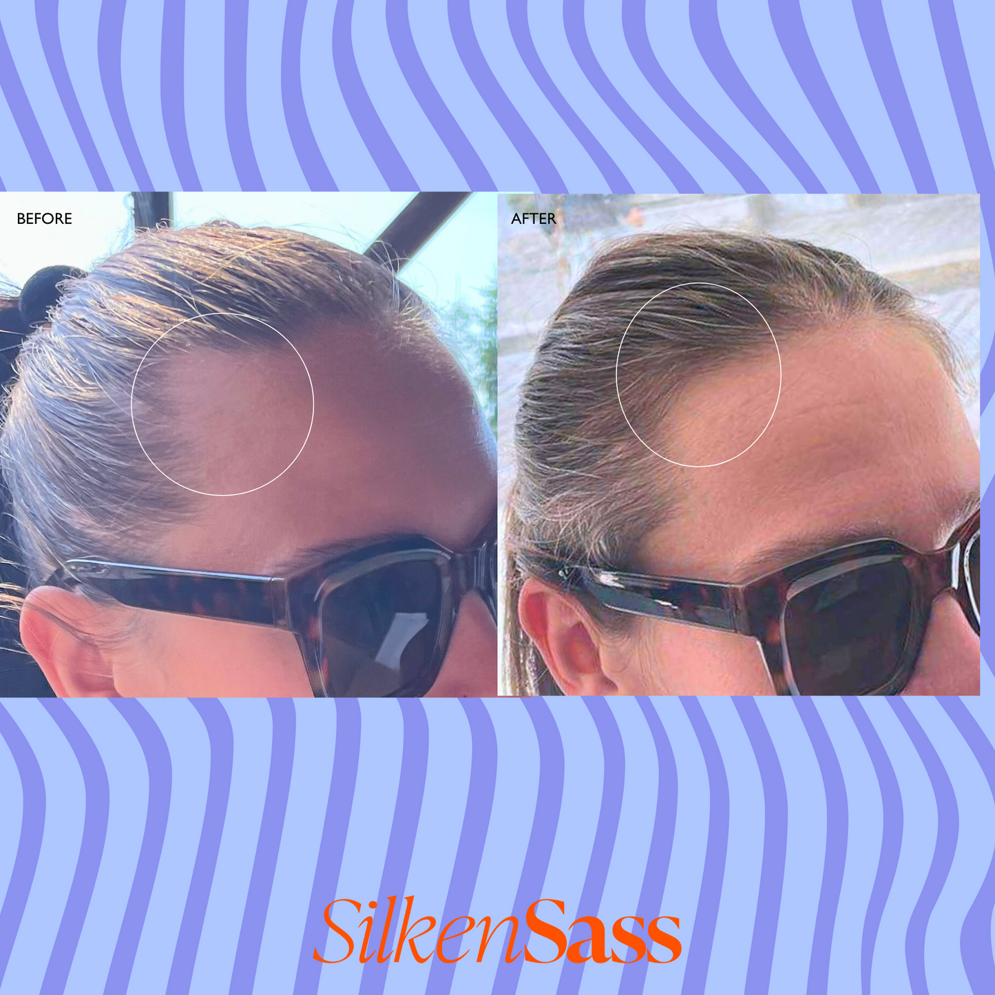Silken Sass Mane Gain Regrowth Serum