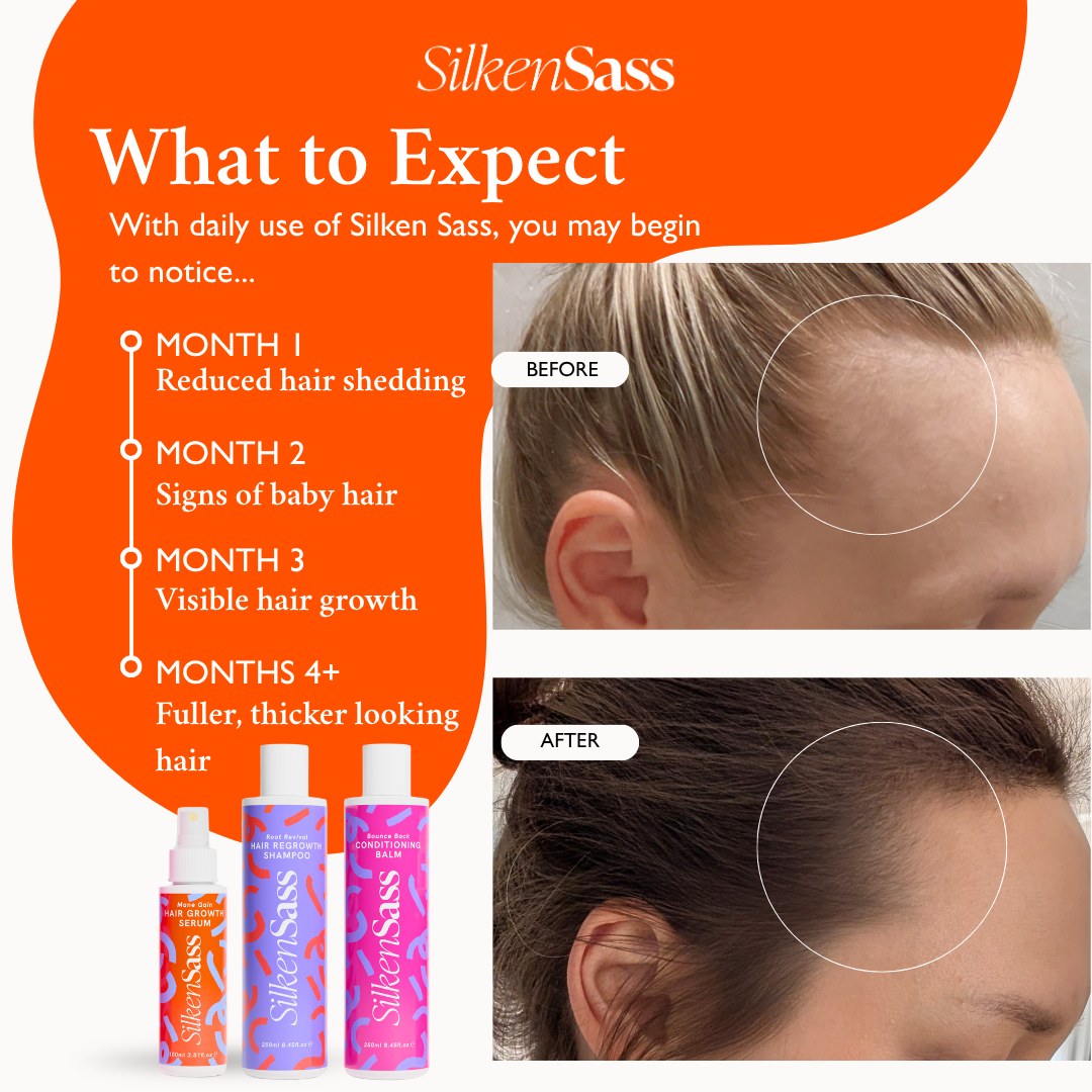 Essential Hair Growth System Bundle | Silken Sass Essential Hair Growth System Bundle | Silken Sass